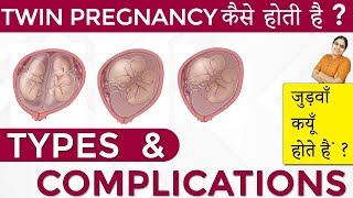 Twins Pregnancy Types Dichorionic Conjoined Monochorionic Diamniotic Monochorionic Monoamniotic [upl. by Etnaled]