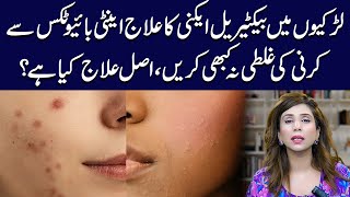 Bacterial Acne Treatment for Girls Top Tips and Tricks  Dr Sahar Chawla [upl. by Neelyam]