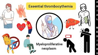 Essential thrombocythemia  Causes  Sign and symptoms  Lab diagnosis  Treatment [upl. by Anirehs6]