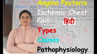 Angina Pectoris in Hindi  Ischemic Chest Pain  Types of Angina  Causes  Pathophysiology  Part 1 [upl. by Ahsenid]