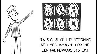 ALS and glial cells [upl. by Herries]