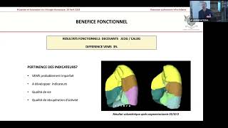 04 Résection pulmonaire infralobaire [upl. by Illoh547]