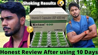 Evion 400 Capsules Honest Review after using 10 Days  Uses Benefits Side Effects [upl. by Viviyan]