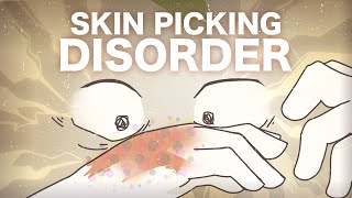 Skin Picking Disorder  What is it [upl. by Enneyehs]