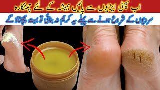 Heal CRACKED Heels FAST With This Simple Remedy [upl. by Copland34]