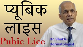 Pubic lice crab lice  प्यूबिक लाइस [upl. by Ann-Marie140]