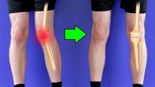 Knee Pain This Is DESTROYING Your Knees [upl. by Arotahs]