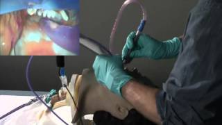 Jarvis Salad Intubation [upl. by Brunn]