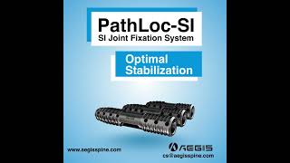 PathLocSI SacroIliac Joint Fixation System [upl. by Dimitry]