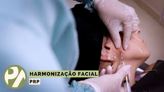 Harmonização Facial  PRP  Programa Pedro Alcântara  17032022 [upl. by Notsa868]