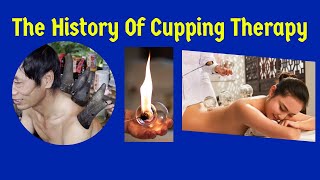 The History of Cupping Therapy An Ancient Healing Practice [upl. by Inail]