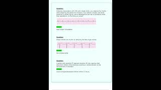 ACLS Pretest Questions Latest 2024 2025 All Correct [upl. by Anyzratak]