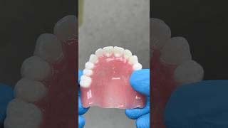 Maxillary Process Denture lsk121shorts dentist [upl. by Ravo974]