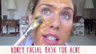 Homemade Honey Facial Mask For Acne  Cassandra Bankson [upl. by Llemart]