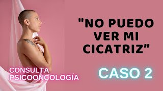 CÓMO AFRONTAR UNA MASTECTOMÍA  Psicología del cáncer [upl. by Marquita]