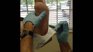 Injection for heel spur plantar fasciitis [upl. by Enialem]