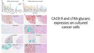 sTRA amp CA199 glycans express on cultured pancreatic cancer cells Code 696 [upl. by Direj]