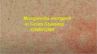 Gram Negative Rods of Morganella morganii in Gram Staining [upl. by Maupin]