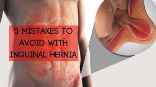 5 Mistakes To Avoid With An Inguinal Hernia [upl. by Auqinihs693]