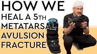 How We Heal a 5th Metatarsal Avulsion Fracture [upl. by Campos370]