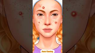 Asmr face pimple treatment animation 😱 shorts ytshorts asmr animation [upl. by Aivartal]