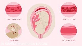 Can you get Pregnant right after your period  Dr Shashi Agrawal [upl. by Tallia]