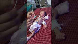 Feeding tube insertion procedure in newborn baby 🐥🍼😍medico youtubeshort viralvideo [upl. by Kara266]