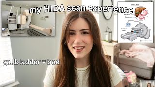 My HIDA Scan Experience i need my gallbladder taken out😪 [upl. by Skees]