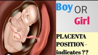 placenta କୋଉ side ରେ ରହିଲେ ମା‌କୁ baby ର active fell ହୁଏanterior ରେ posterior ରେ [upl. by Ecitnirp683]