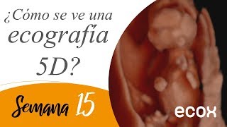 Ecografia de 15 semanas de embarazo Increíble 😮 [upl. by Zerlina912]