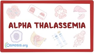 Alphathalassemia  an Osmosis Preview [upl. by Hildagard]