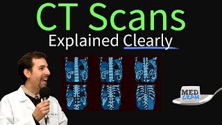 CT Scan of the Chest Explained Clearly  High Resolution CT Scan HRCT [upl. by Richard]