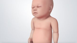 Infant Distress Warning Signs Grunting Baby Sound [upl. by Rabaj997]