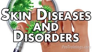 Skin Diseases and Disorders [upl. by Ttennaj657]