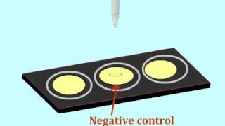 Agglutination assay to detect antigens  MultiLingual Captions [upl. by Eidnar]