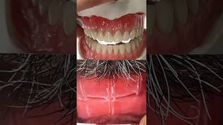 From Bite Block to TryIn dental teeth smile lsk121shorts dentures shortvideo shorts [upl. by Akcirre716]