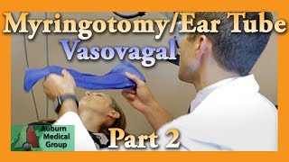 Myringotomy amp Ear Tube Part 2 Vasovagal Feat Dr Tim Fife  Auburn Medical Group [upl. by Brenna]