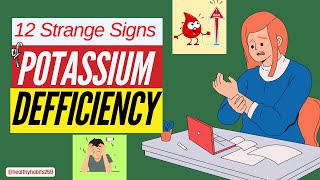 12 Unique Signs You Need More Potassium  Potassium Deficiency [upl. by Whitehurst]