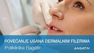 Povećanje usana dermalnim filerima [upl. by Assilaj]