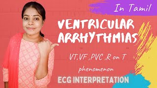 Ventricular Arrhythmias  ECG Interpretation in Tamil  VT VF PVC R on T Phenomenon [upl. by Soloma]