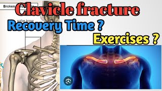 clavicle fracture recovery time  Clavicle Fracture recovery exercises  collar bone  in Hindi [upl. by Cavil]