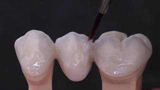 TECNICA 441 di microstratificazione liquida della zirconia KATANA  Video by Odt D Rondoni [upl. by Arbrab]