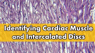 Fibrocartilage vs Cardiac Muscle Histology FAQ [upl. by Barimah980]