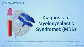 Diagnosis of Myelodysplastic Syndromes MDS [upl. by Dan]