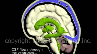 Hydrocephalus and Cerebrospinal Fluid CSF circulation by Dr Cal Shipley MD [upl. by Burnight]