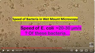 Speed of Bacteria in Wet Mount Microscopy Citrobacter farmeri Mag1600X [upl. by Eimar]