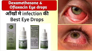 ofloxacin dexamethasone eye drops use dosage side effects in hindi  OFC DX eye drops in hindi [upl. by Kronfeld]