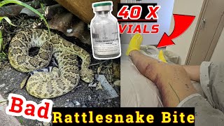 Rattlesnake Bite While Herping Central Texas [upl. by Ealasaid]