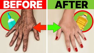 Get Rid Of WRINKLES amp Hand Dryness Transform Your Hands INSTANTLY [upl. by Ancel]