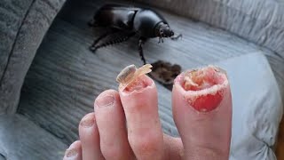 these bugs can eat toes [upl. by Ardnahc957]